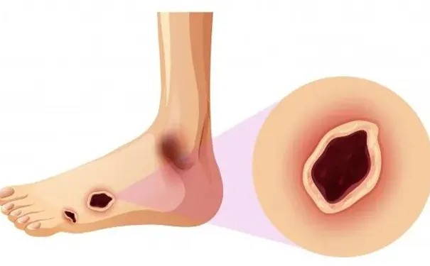 杭州博养压疮治疗中心 杭州博养压疮治疗中心