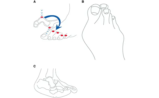 杭州博养压疮治疗中心 杭州博养压疮治疗中心