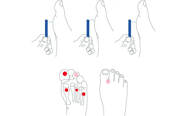 杭州博养压疮治疗中心 杭州博养压疮治疗中心