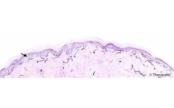 杭州博养压疮治疗中心 杭州博养压疮治疗中心