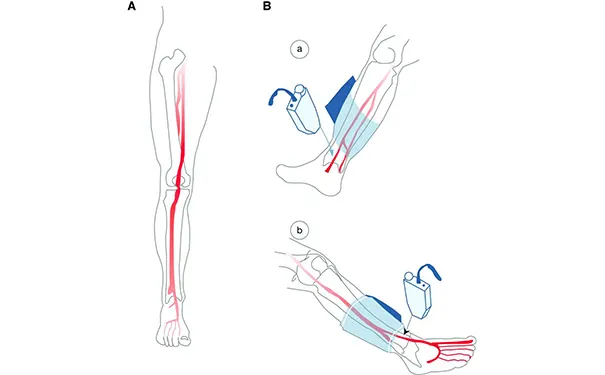 杭州博养压疮治疗中心 杭州博养压疮治疗中心