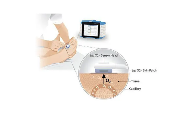 杭州博养压疮治疗中心 杭州博养压疮治疗中心