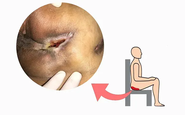 杭州博养压疮治疗中心 杭州博养压疮治疗中心