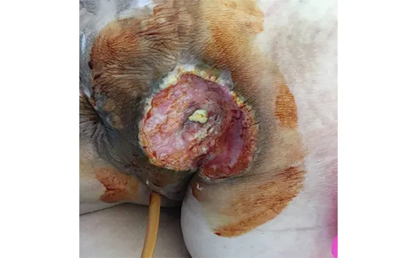 杭州博养压疮治疗中心 杭州博养压疮治疗中心