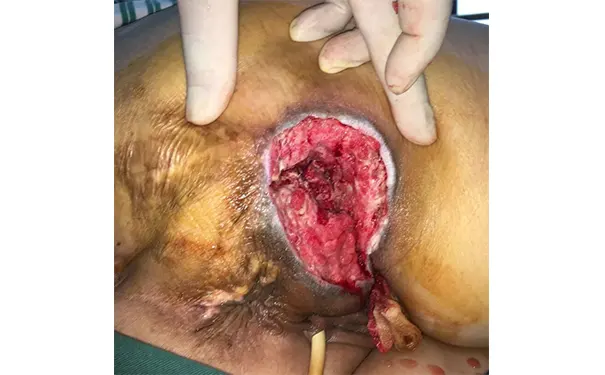 杭州博养压疮治疗中心 杭州博养压疮治疗中心