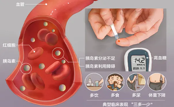 杭州博养压疮治疗中心 杭州博养压疮治疗中心