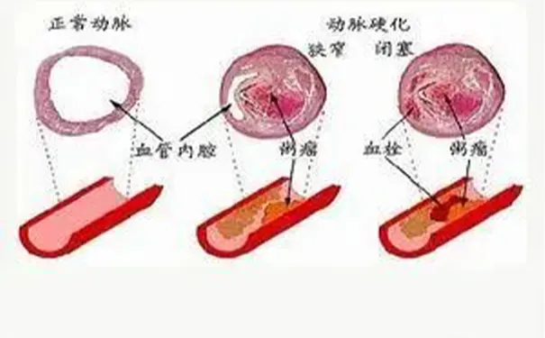 杭州博养压疮治疗中心 杭州博养压疮治疗中心