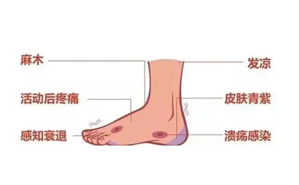 杭州博养压疮治疗中心