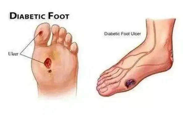 杭州博养压疮治疗中心