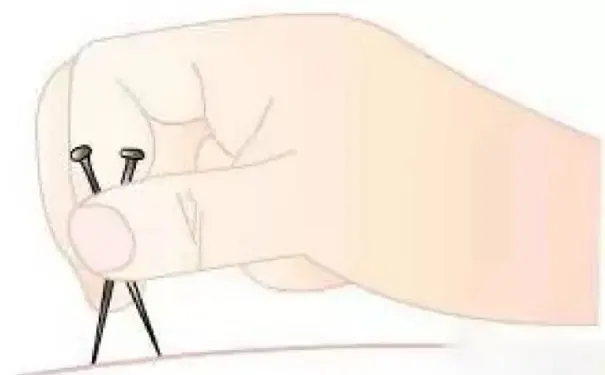 杭州博养压疮治疗中心 杭州博养压疮治疗中心