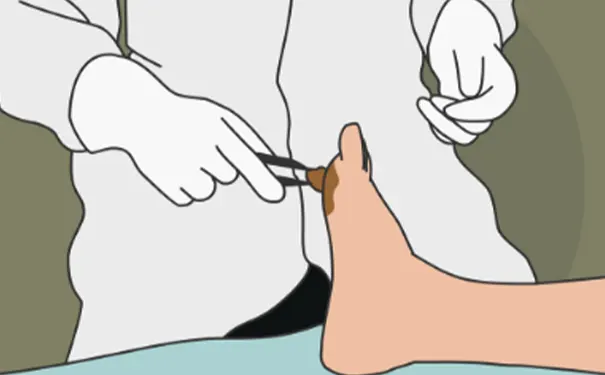 杭州博养压疮治疗中心 杭州博养压疮治疗中心