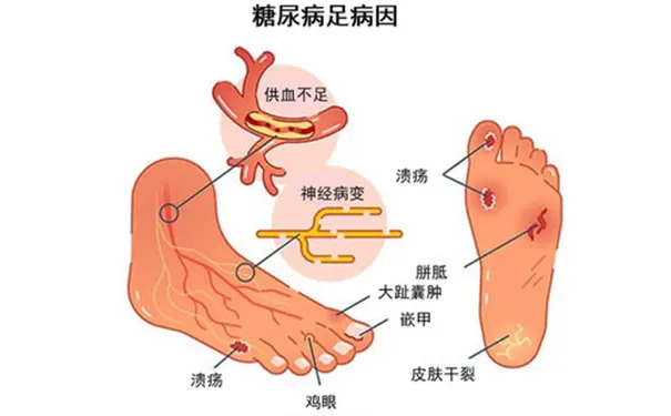 杭州博养压疮治疗中心 杭州博养压疮治疗中心