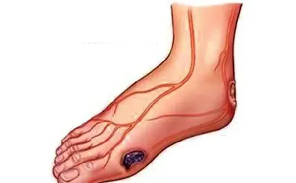 杭州博养压疮治疗中心 杭州博养压疮治疗中心