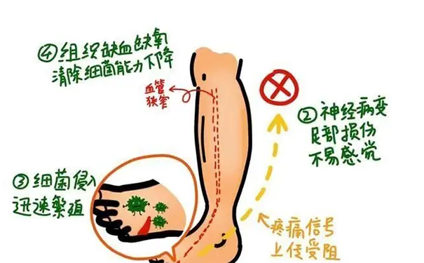 杭州博养压疮治疗中心 杭州博养压疮治疗中心