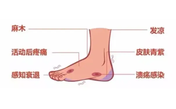 杭州博养压疮治疗中心 杭州博养压疮治疗中心