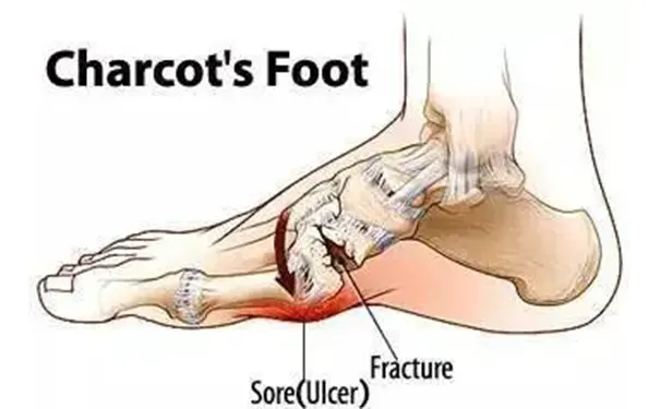 杭州博养压疮治疗中心 杭州博养压疮治疗中心