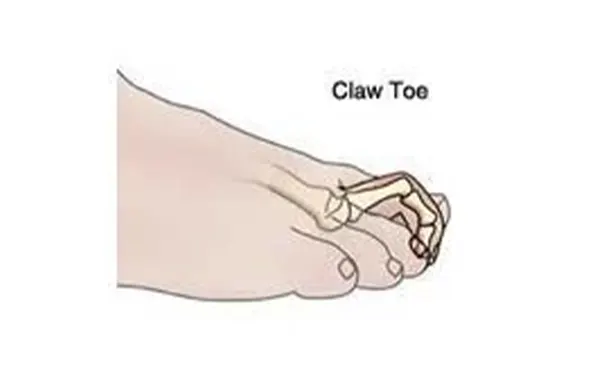 杭州博养压疮治疗中心 杭州博养压疮治疗中心