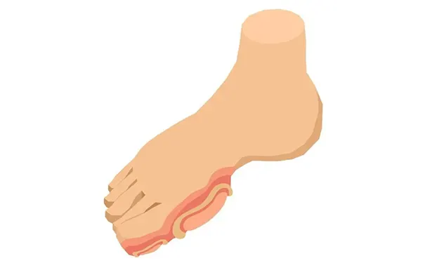 杭州博养压疮治疗中心 杭州博养压疮治疗中心