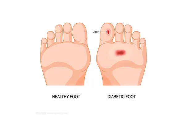杭州博养压疮治疗中心 杭州博养压疮治疗中心