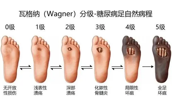 杭州博养压疮治疗中心 杭州博养压疮治疗中心