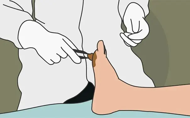 杭州博养压疮治疗中心 杭州博养压疮治疗中心