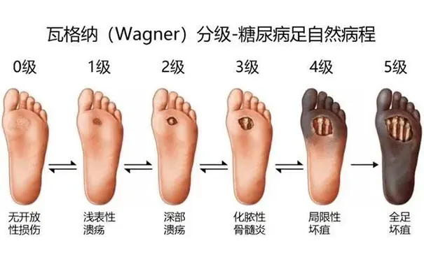 杭州博养压疮治疗中心 杭州博养压疮治疗中心