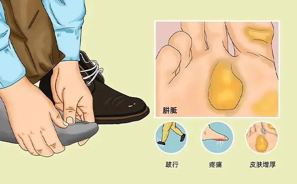 杭州博养压疮治疗中心 杭州博养压疮治疗中心