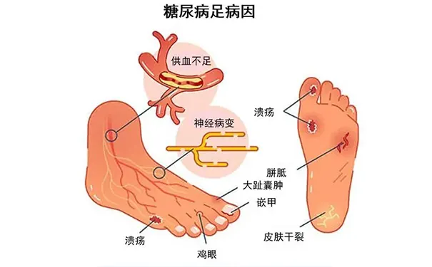 杭州博养压疮治疗中心 杭州博养压疮治疗中心