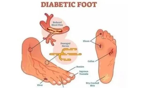 杭州博养压疮治疗中心 杭州博养压疮治疗中心