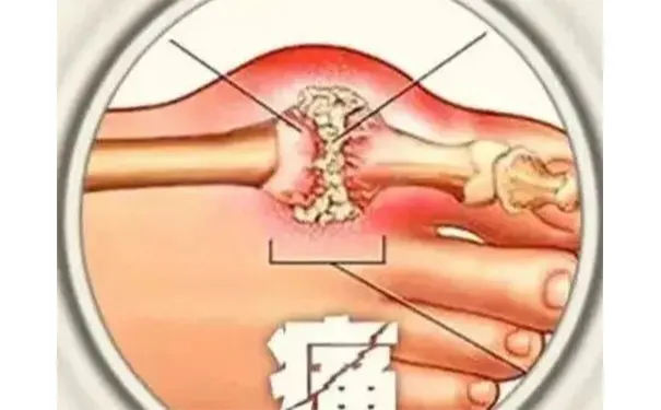 杭州博养压疮治疗中心 杭州博养压疮治疗中心