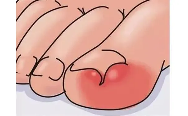 杭州博养压疮治疗中心 杭州博养压疮治疗中心