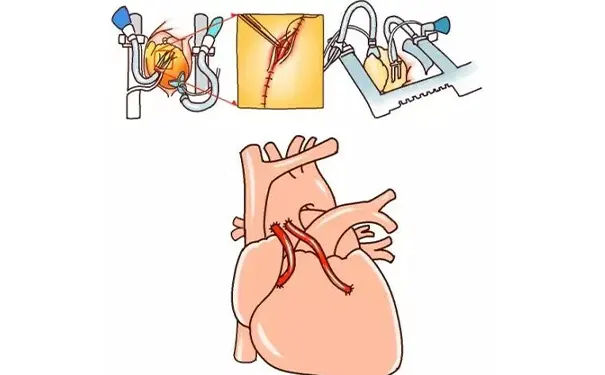 杭州博养压疮治疗中心 杭州博养压疮治疗中心