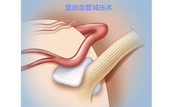 杭州博养压疮治疗中心 杭州博养压疮治疗中心