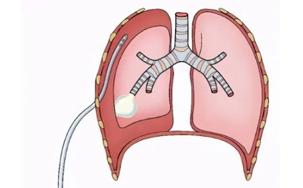 杭州博养压疮治疗中心 杭州博养压疮治疗中心