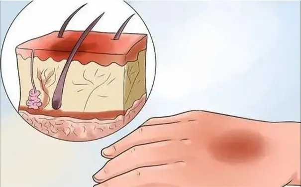 杭州博养压疮治疗中心 杭州博养压疮治疗中心