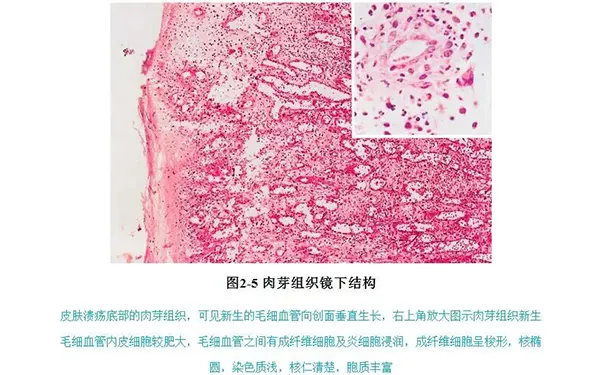 杭州博养压疮治疗中心 杭州博养压疮治疗中心