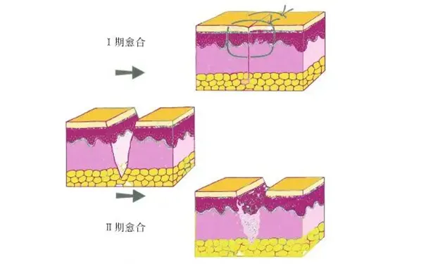 杭州博养压疮治疗中心 杭州博养压疮治疗中心