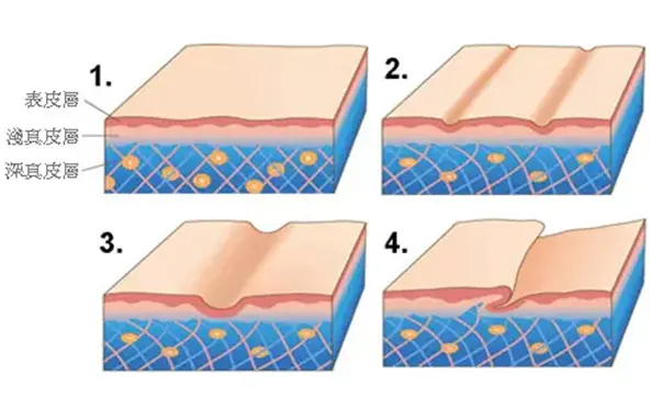 杭州博养压疮治疗中心 杭州博养压疮治疗中心