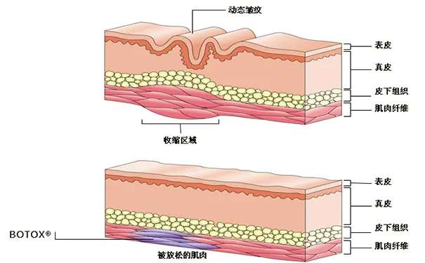 杭州博养压疮治疗中心 杭州博养压疮治疗中心