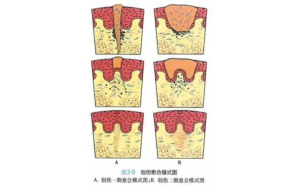 杭州博养压疮治疗中心 杭州博养压疮治疗中心