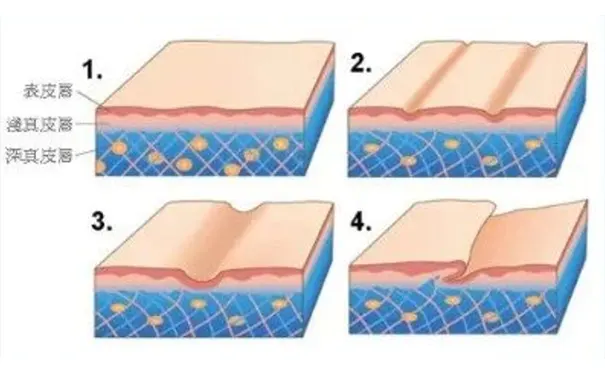 杭州博养压疮治疗中心 杭州博养压疮治疗中心