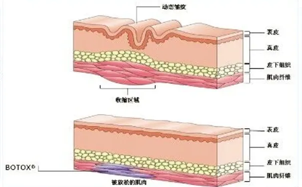 杭州博养压疮治疗中心 杭州博养压疮治疗中心