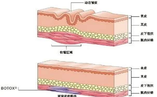 杭州博养压疮治疗中心
