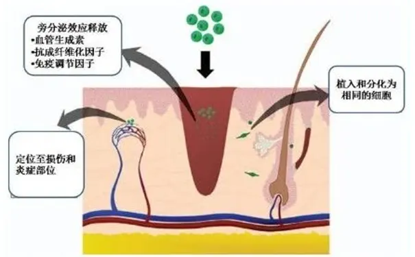 杭州博养压疮治疗中心