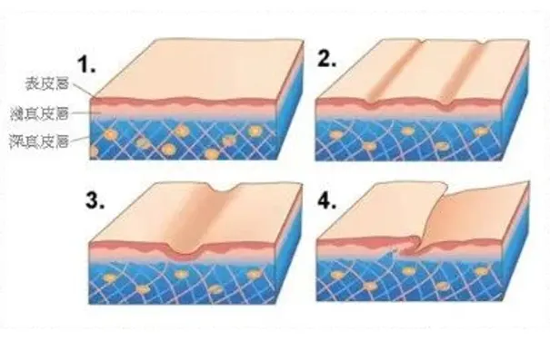 杭州博养压疮治疗中心 杭州博养压疮治疗中心