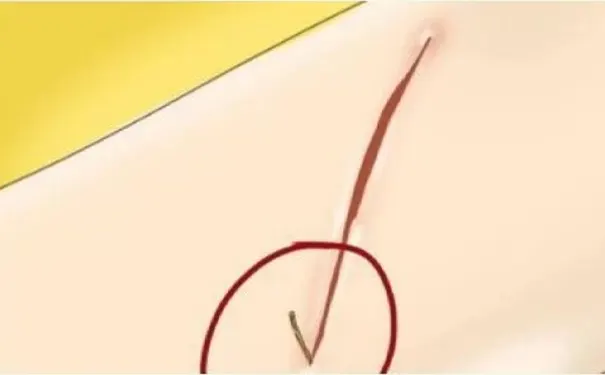 杭州博养压疮治疗中心 杭州博养压疮治疗中心