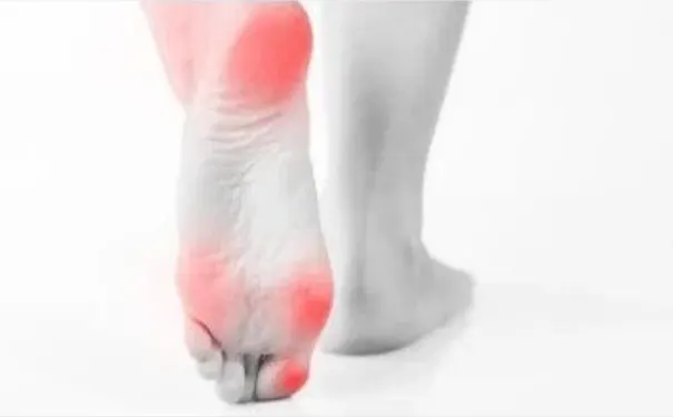 杭州博养压疮治疗中心