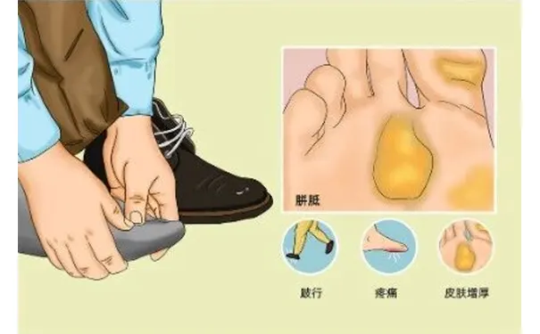 杭州博养压疮治疗中心