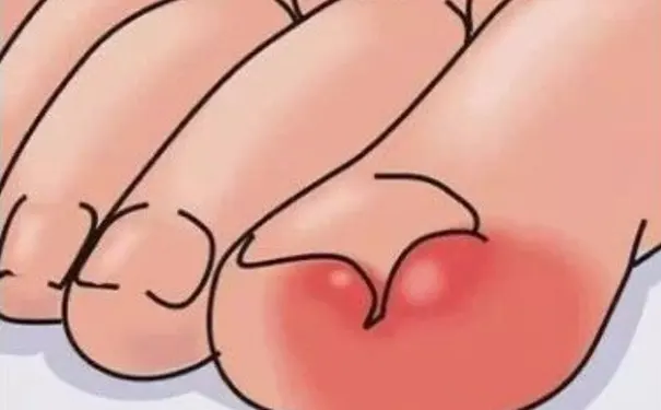 杭州博养压疮治疗中心