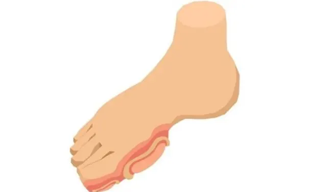 杭州博养压疮治疗中心